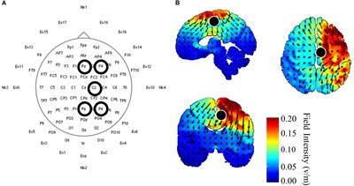 Single Sessions of High-Definition Transcranial Direct Current Stimulation Do Not Alter Lower Extremity Biomechanical or Corticomotor Response Variables Post-stroke